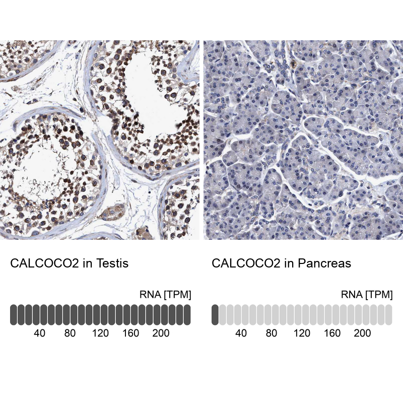 Anti-CALCOCO2 Antibody