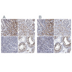 Immunohistochemical staining of human gastrointestinal, kidney, pancreas and testis using Anti-CALCOCO2 antibody HPA022989 (A) shows similar protein distribution across tissues to independent antibody HPA023019 (B).