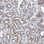 Immunohistochemical staining of human kidney shows moderate cytoplasmic positivity in cells in tubules.