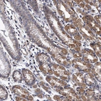 Immunohistochemical staining of human stomach shows moderate cytoplasmic positivity in glandular cells.