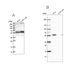 Western blot analysis using Anti-CALCOCO2 antibody HPA022989 (A) shows similar pattern to independent antibody HPA023195 (B).