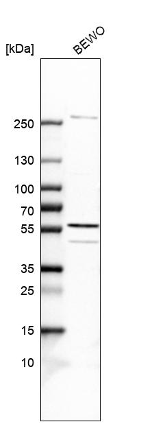 Anti-SPOUT1 Antibody