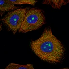 Immunofluorescent staining of human cell line PC-3 shows localization to nucleoli, nucleus and cytosol.
