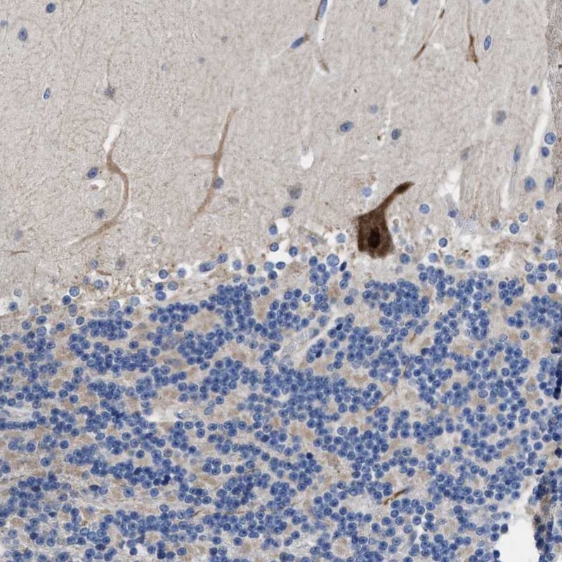 Anti-DHRS13 Antibody