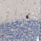 Anti-DHRS13 Antibody