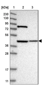 Lane 1: Marker [kDa] 230, 130, 95, 72, 56, 36, 28, 17, 11_br/_Lane 2: Human cell line RT-4_br/_Lane 3: Human cell line U-251MG sp