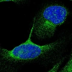 Immunofluorescent staining of human cell line U-2 OS shows localization to vesicles.