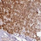 Anti-CCDC144A Antibody