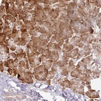 Anti-CCDC144A Antibody