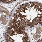 Immunohistochemical staining of human testis shows strong cytoplasmic positivity in cells in seminiferous ducts.