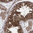 Immunohistochemical staining of human testis shows strong cytoplasmic positivity in cells in seminiferous ducts.