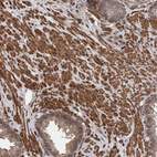 Immunohistochemical staining of human prostate shows strong cytoplasmic positivity in smooth muscle cells.