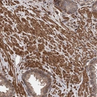 Immunohistochemical staining of human prostate shows strong cytoplasmic positivity in smooth muscle cells.