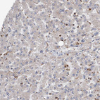Immunohistochemical staining of human liver shows very weak cytoplasmic positivity in hepatocytes.