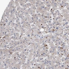 Immunohistochemical staining of human liver shows very weak cytoplasmic positivity in hepatocytes.