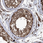 Anti-CHMP6 Antibody