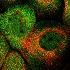 Immunofluorescent staining of human cell line A-431 shows localization to nucleoplasm & cytosol.