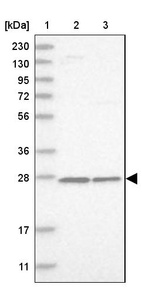 Lane 1: Marker [kDa] 230, 130, 95, 72, 56, 36, 28, 17, 11_br/_Lane 2: Human cell line RT-4_br/_Lane 3: Human cell line U-251MG sp