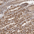 Anti-FAM221B Antibody