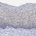 Immunohistochemical staining of human cervix, uterine shows weak to moderate nuclear positivity in epidermal cells.