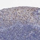 Immunohistochemical staining of human tonsil shows moderate nuclear positivity in squamous epithelial cells.