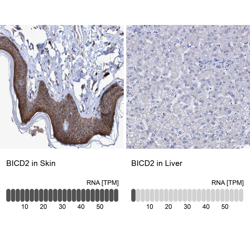 Anti-BICD2 Antibody