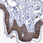 Immunohistochemical staining of human skin shows strong cytoplasmic positivity in squamous epithelial cells.