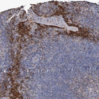 Immunohistochemical staining of human tonsil shows strong cytoplasmic positivity in squamous epithelial cells.