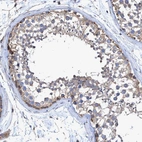 Immunohistochemical staining of human testis shows weak cytoplasmic positivity in subset of cells in seminiferous ducts.