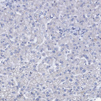 Immunohistochemical staining of human liver shows no positivity in hepatocytes as expected.