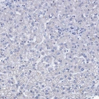 Immunohistochemical staining of human liver shows no positivity in hepatocytes as expected.
