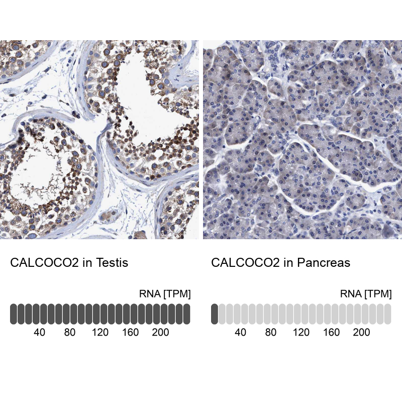 Anti-CALCOCO2 Antibody