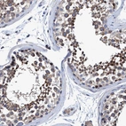 Immunohistochemical staining of human testis shows strong cytoplasmic positivity in cells in seminiferous ducts.