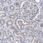 Immunohistochemical staining of human kidney shows weak cytoplasmic positivity in cells in tubules.