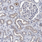 Immunohistochemical staining of human kidney shows weak cytoplasmic positivity in cells in tubules.