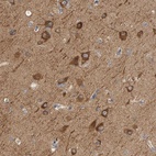 Anti-KLHL11 Antibody