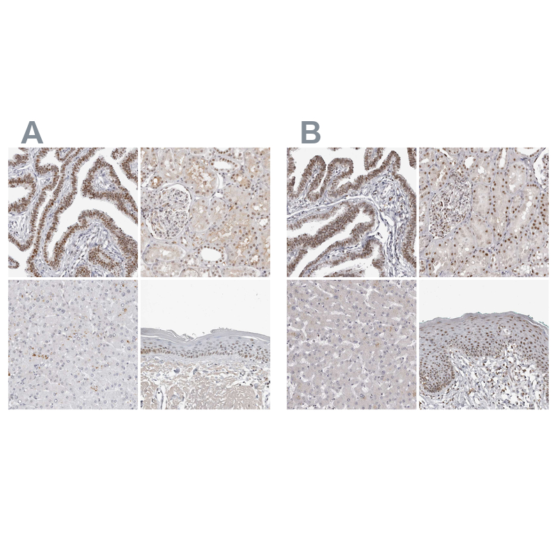Anti-WRAP53 Antibody