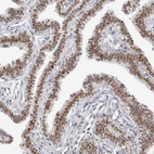 Immunohistochemical staining of human Fallopian tube shows moderate nuclear positivity in glandular cells.