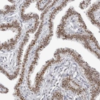 Immunohistochemical staining of human Fallopian tube shows moderate nuclear positivity in glandular cells.