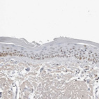 Immunohistochemical staining of human skin shows weak nuclear positivity in squamous epithelial cells.