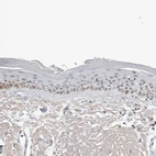 Immunohistochemical staining of human skin shows weak nuclear positivity in squamous epithelial cells.