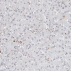 Immunohistochemical staining of human liver shows no positivity in hepatocytes as expected.