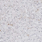 Immunohistochemical staining of human liver shows no positivity in hepatocytes as expected.