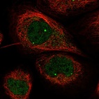 Immunofluorescent staining of human cell line A-431 shows localization to nuclear bodies.