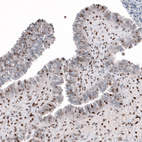 Immunohistochemical staining of human fallopian tube shows moderate to strong nuclear positivity in glandular cells, as well as in lymphoid cells.