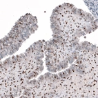 Immunohistochemical staining of human fallopian tube shows moderate to strong nuclear positivity in glandular cells, as well as in lymphoid cells.