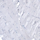 Immunohistochemical staining of human skeletal muscle shows no positivity in myocytes as expected.