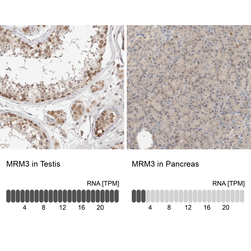 Anti-MRM3 Antibody