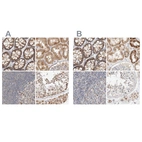 Immunohistochemical staining of human colon, kidney, lymph node and testis using Anti-MRM3 antibody HPA023031 (A) shows similar protein distribution across tissues to independent antibody HPA022534 (B).