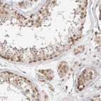 Immunohistochemical staining of human testis shows high expression.